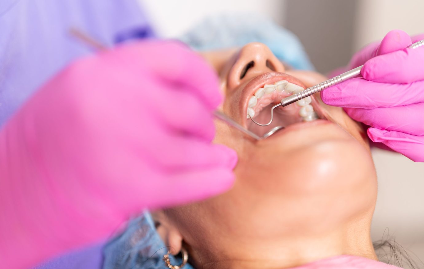Over-the-shoulder view of a dentist using dental instruments on a patient in a dental clinic.